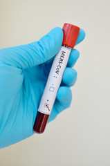 Naklejka premium MERS-CoV positive