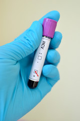 Obraz premium Hepatitis C virus positive