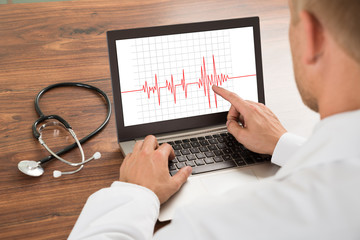 Doctor Looking At Heartbeat Cardiogram