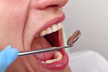 Obraz premium The dentist inserts the swab