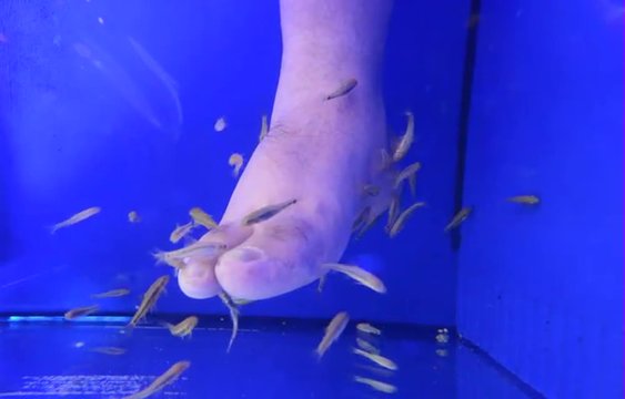 Man lag receive Ichthyotherapy, use of fish garra rufa , for cleaning skin wounds or treating other skin conditions. 