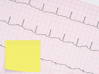 Electrocardiogram, ECG detail. With blank sticky note for messag