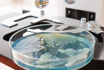Petri dish infected with bacteria under the light of the laboratory microscope. Medical laboratory concept