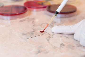 Laboratory doctor or scientific researcher preparing for a smear test or blood film. Using a pipette the doctor will put a drop of blood on the sterile slide - obrazy, fototapety, plakaty