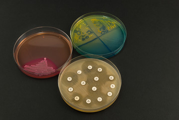 Petri dishes on black background