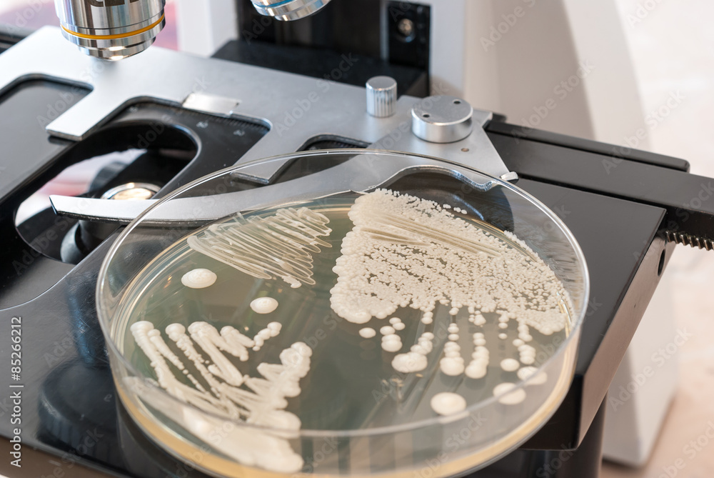 Wall mural petri dish with fungus on laboratory microscope. candida albicans fungus on agar dish