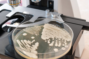 Petri dish with fungus on laboratory microscope. Candida albicans fungus on agar dish