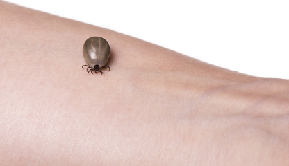 Obraz premium Tick on a skin