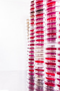 Agar plates