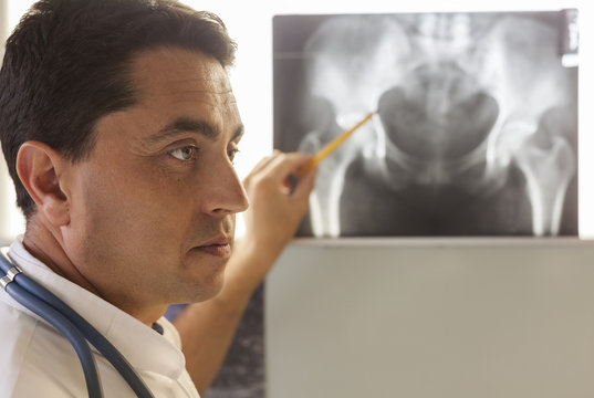 Doctor pointing at x-ray of a pelvis