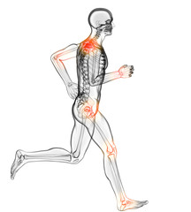 Gelenkschmerzen, Illustration 3D