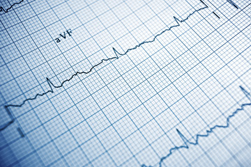 Electrocardiogram