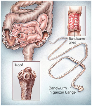 Bandwurm im Darm
