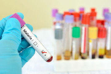 Fototapeta premium Malaria positive