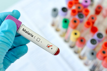 Obraz premium Malaria positive
