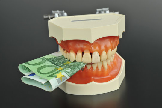 Zähne, Zahn, Kostenvoranschlag, Zahnersatz, Eigenanteil, Krankenkasse, Kostenplan, Kosten, Prophylaxe