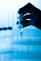 Human Sperm, Artificial Insemination, Test Tube.