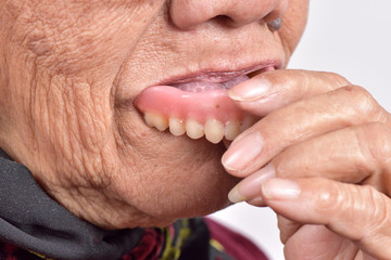 false tooth