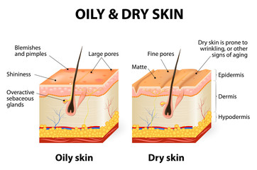 Oily & dry skin