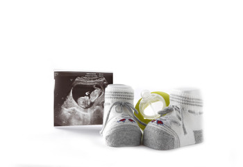 baby booties
