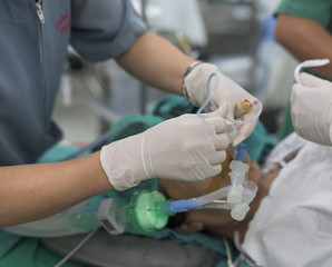 nurse suction endotracheal tube