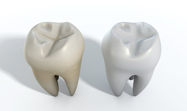 Dirty Clean Tooth Comparison
