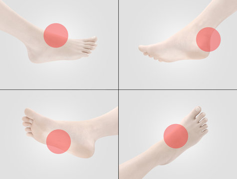 Piedi con dolori tallone pianta alluce