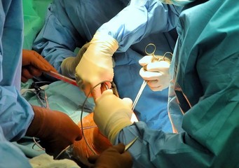 Prosthesis of the knee hospital operation