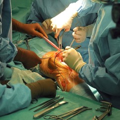 Prosthesis of the knee hospital operation