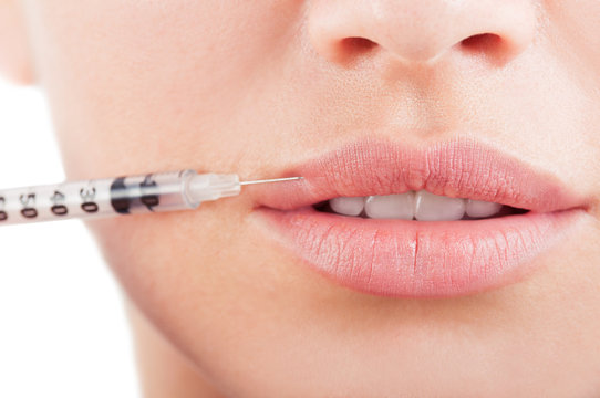 Close-up mouth and lips with cosmetic injection