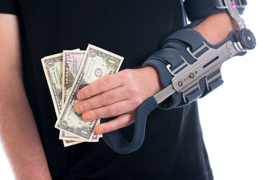 man with broken arm showing dollars
