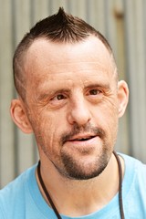 Close up portrait d'un garçon avec le syndrome de Down