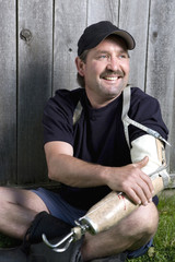 Man with artificial arm sitting in the grass.