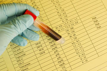 High lipid profile results