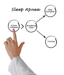 Sleep Apnea