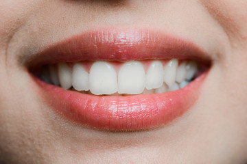 close-up of a beautiful woman mouth white teeth and glossy lips