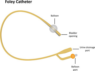 Foley Catheter Labeled