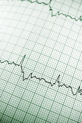 Electrocardiogram