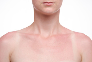 tanned skin in the sun