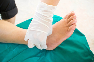 diabatic foot skining neuropathy