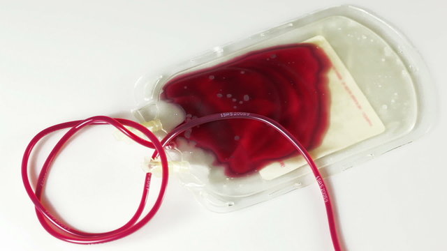 A blood bag being filled with blood. Timelapse