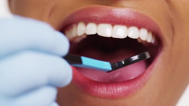 Close up of smiling black woman at dentist