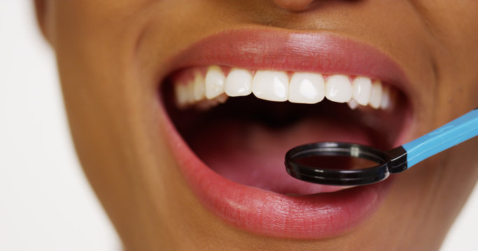 Mouth and teeth of black woman in dental examination