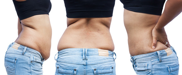 women body fat belly between before and after weight loss