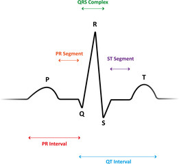 ECG Waveform