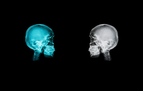 skull x-ray image isolate on black backgroud with clipping path