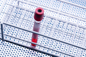Sample of developed  genetics vaccines  in laboratory