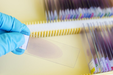 Blood film for blood cell and malaria morphology