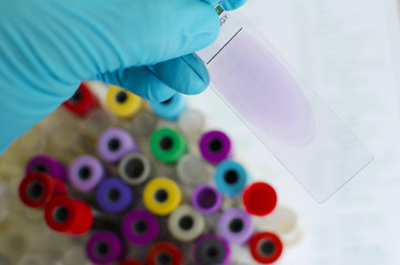 Blood film for blood cell and malaria morphology