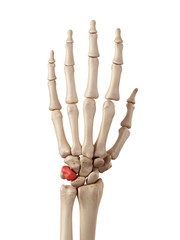 medical accurate illustration of the triquetrum bone